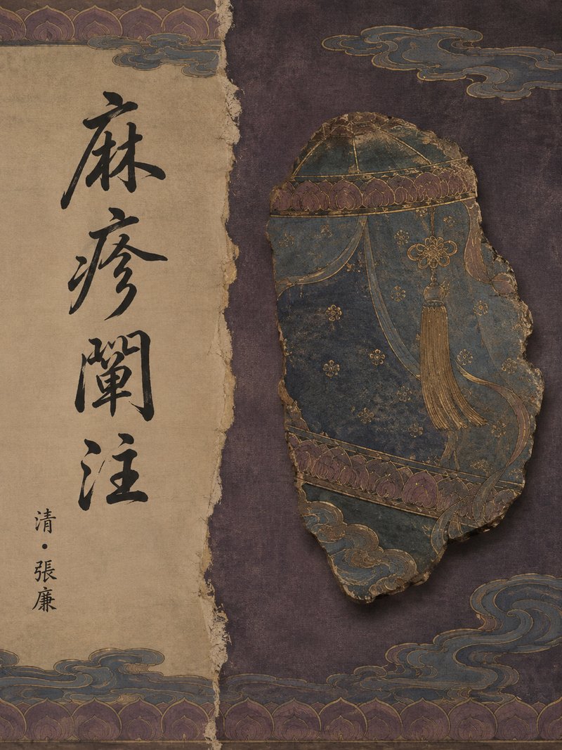 麻疹阐注